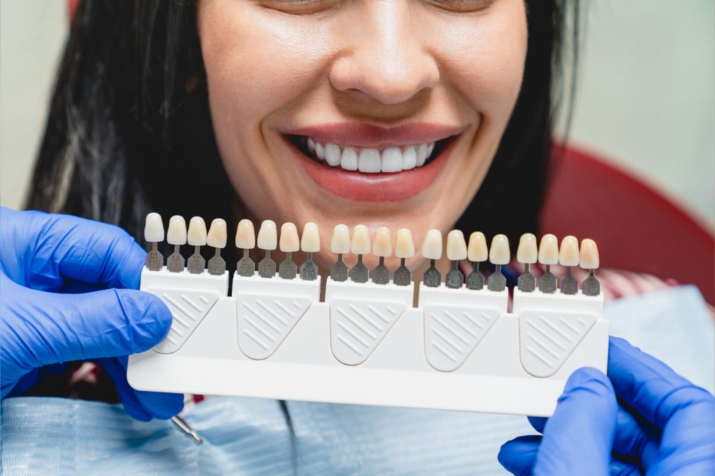 Veneer Teeth