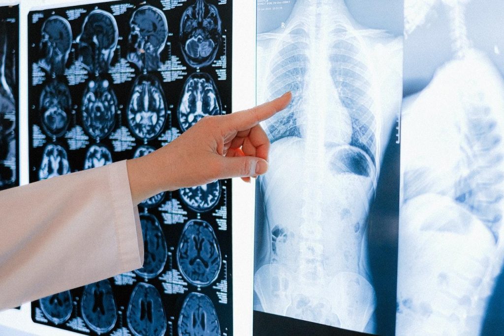 Catastrophic Injury Accident