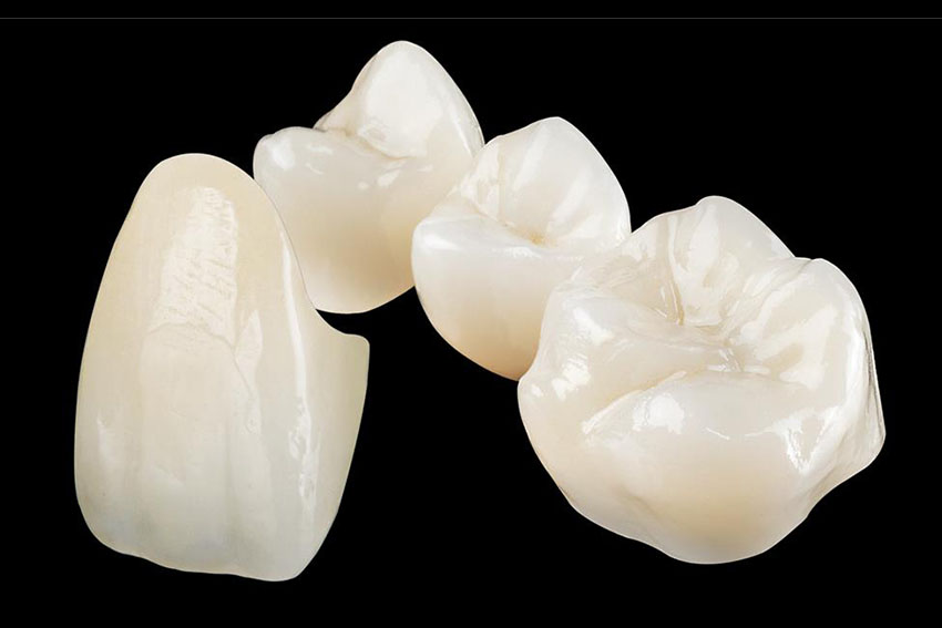 Ceramic Crowns