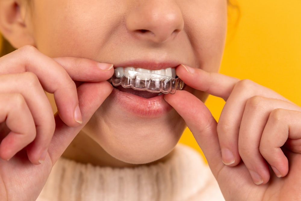 Role of Orthodontics in Sleep Apnea