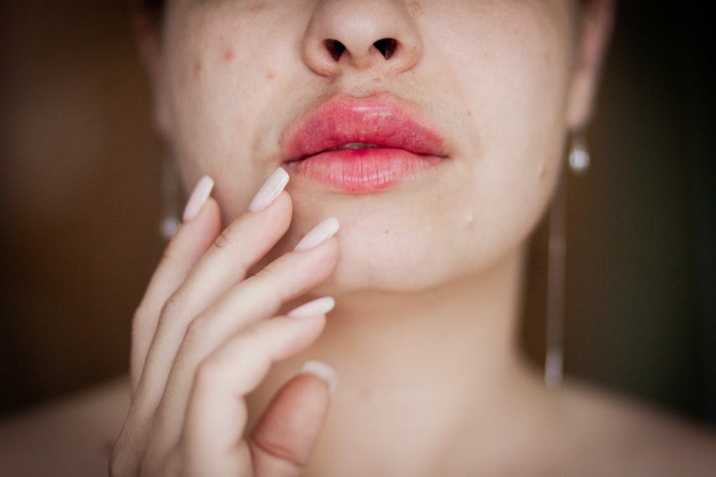 benefits of Derma Filler