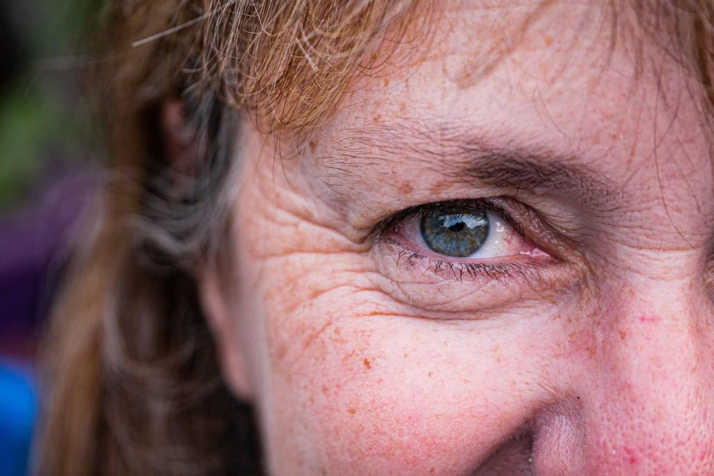 Tips Reduce Wrinkles From The Comfort Of Your Home