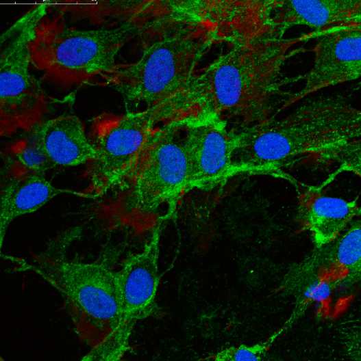 Mesenchymal Stem Cells