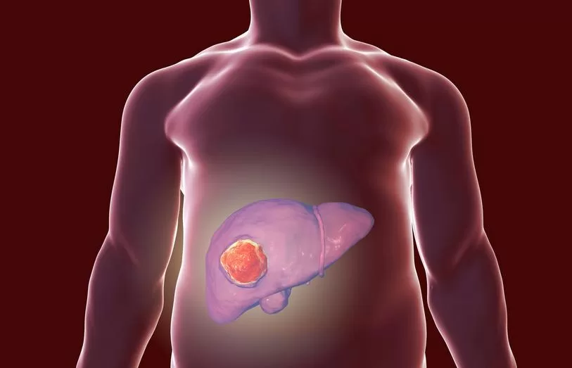 What are 3 ways alcohol can cause liver damage?
